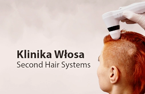 SecondHair Systems