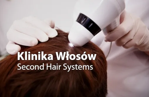 SecondHair Systems