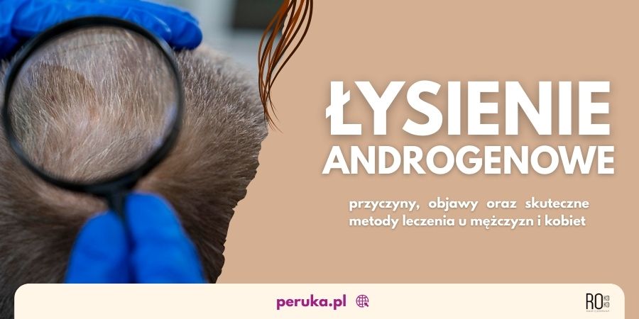 Łysienie androgenowe u&nbsp;kobiet i&nbsp;mężczyzn - przyczyny i&nbsp;leczenie
